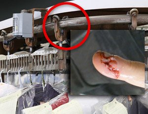 garment-conveyor-safety-injury